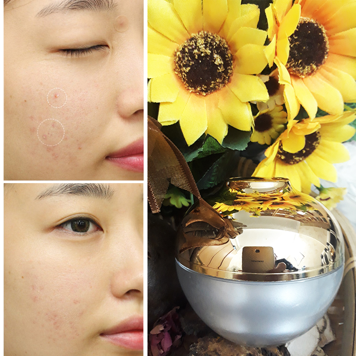 Kem trị mụn thảo dược BeU dùng cho mụn mủ, mụn bọc, mụn viêm 20ml