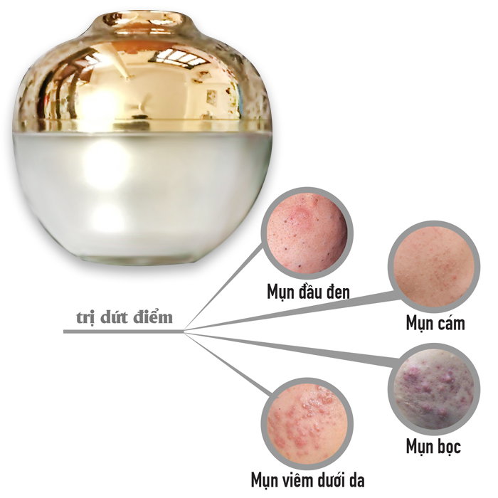 Kem trị mụn thảo dược BeU dùng cho mụn mủ, mụn bọc, mụn viêm 20ml